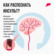 У врачей есть только 3,5–6 часов, чтобы спасти от инвалидности человека, перенёсшего инсульт